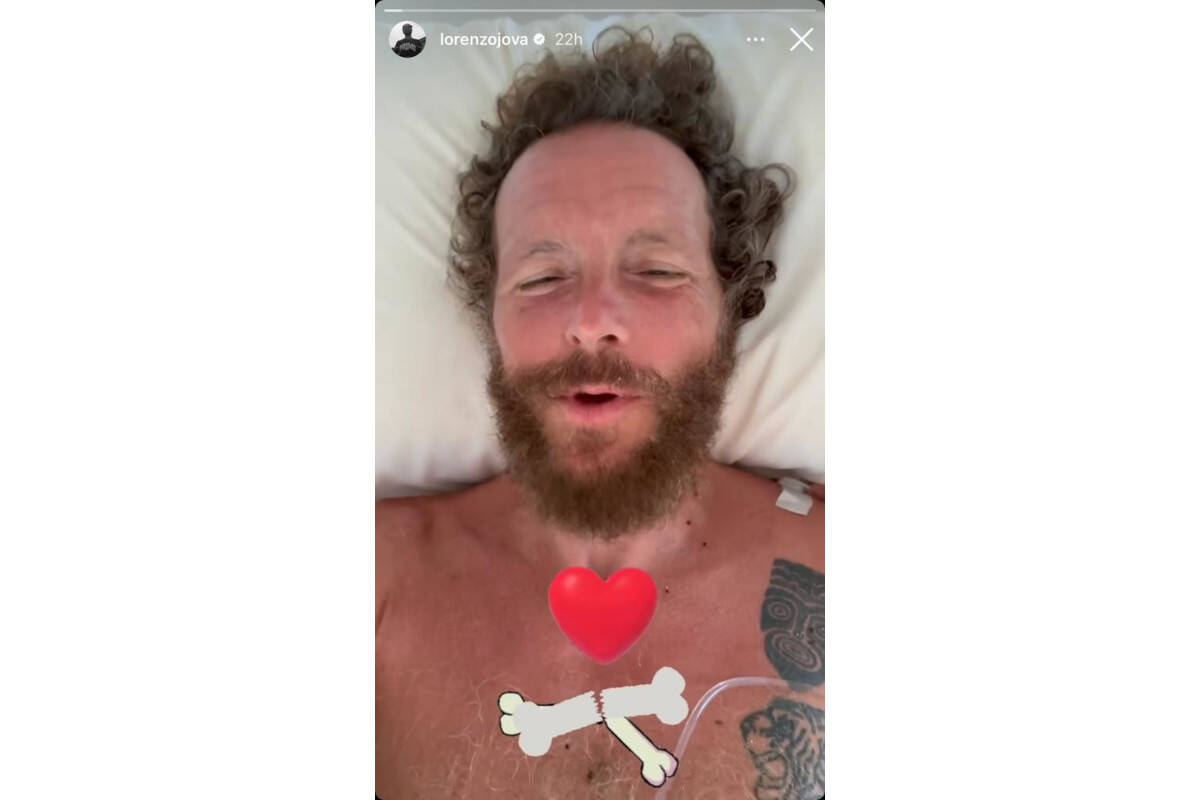 Jovanotti dopo l'infortunio in Repubblica Dominicana