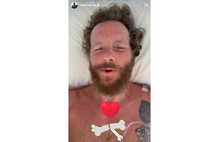 Jovanotti dopo l'infortunio in Repubblica Dominicana