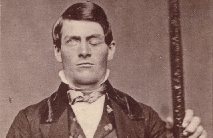 Phineas Gage uomo con occhiu chiuso in foto seppia